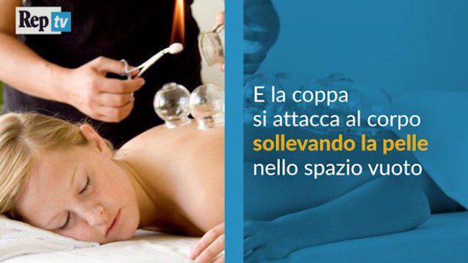 Cerchi rossi sul corpo degli atleti olimpici: la cupping therapy