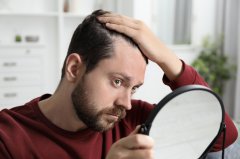 Caduta capelli
